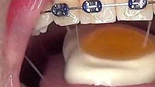 Playing and Swallowing Gummy Eggs
