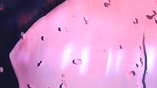 B010 CBT Urethral Probing