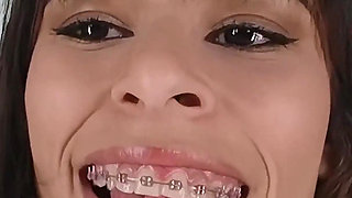 Cute Braces Teen Fisting Her Tight Asshole